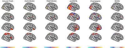 Source localization using recursively applied and projected MUSIC with flexible extent estimation